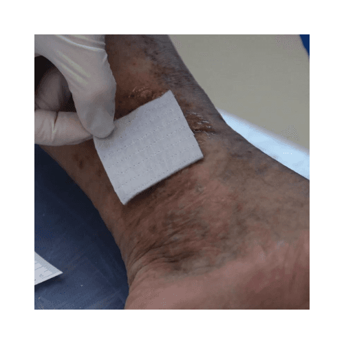 AQUACEL Ag Dressing, 10 × 10 cm