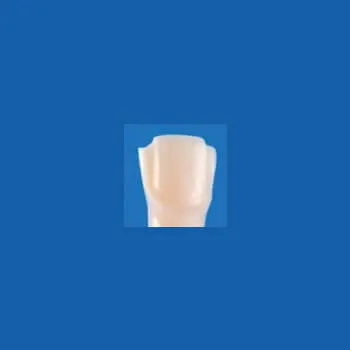 A25AN-UR19J, Pre-Prepared Tooth #11 (Veneer)