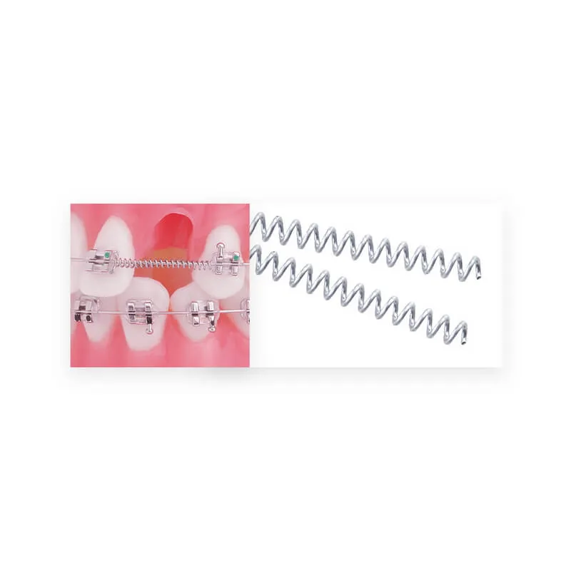 زنبرك ملفوف مفتوح TruFlex NiTi بكرة/7", 10x30, PK/3
