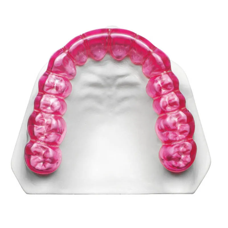 DURASOFT Seal, Magenta (0.1x125mm), Discoloration Layer
