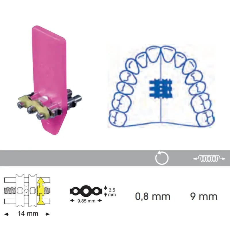 Standard Expansion Screw For Upper Jaw, 11mm