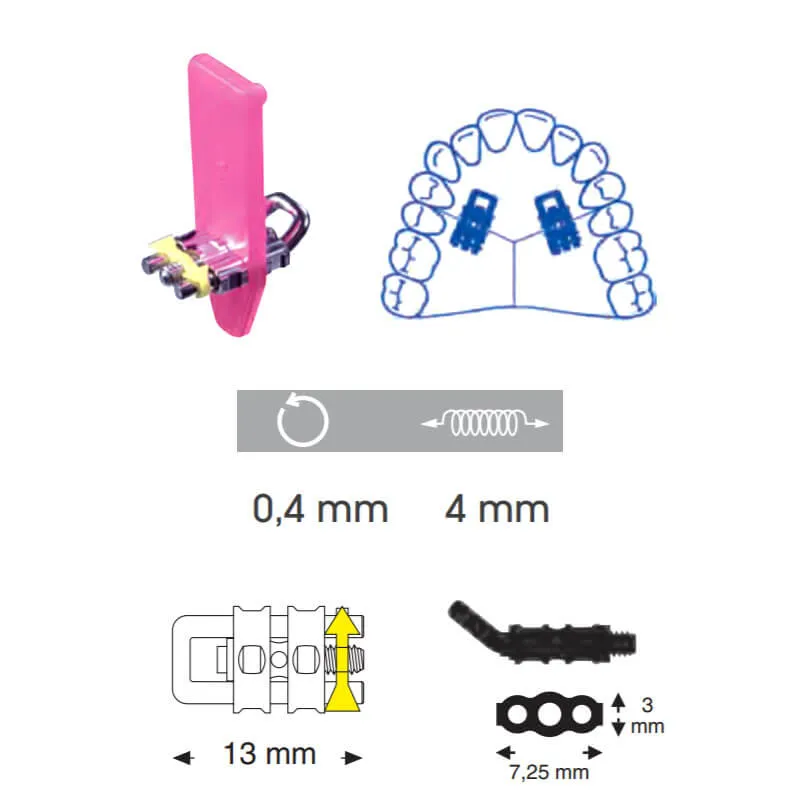 Micro Sectional Screws، U-Bent، Upper، 13 mm